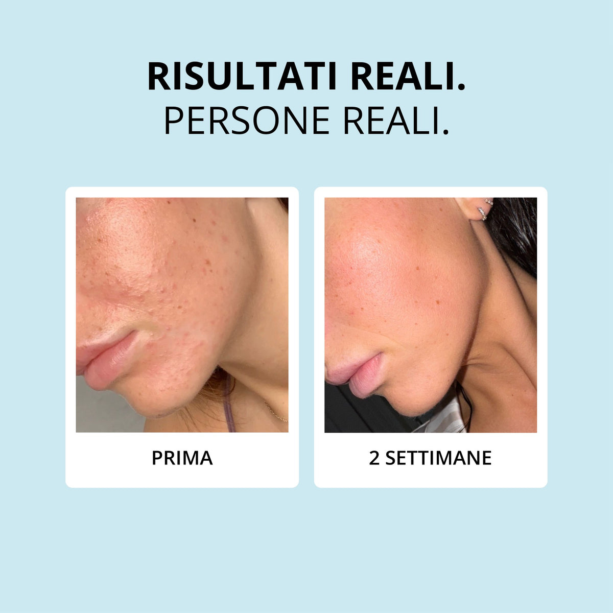 Glowwa Collagen Creamer: risultati reali, prima e dopo 2 settimane