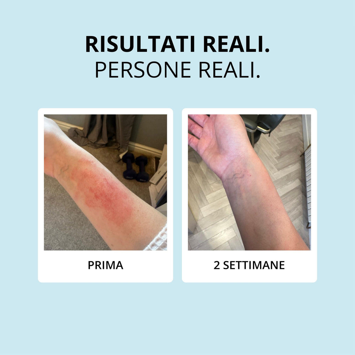 Glowwa Collagen Creamer: risultati reali, prima e dopo 2 settimane
