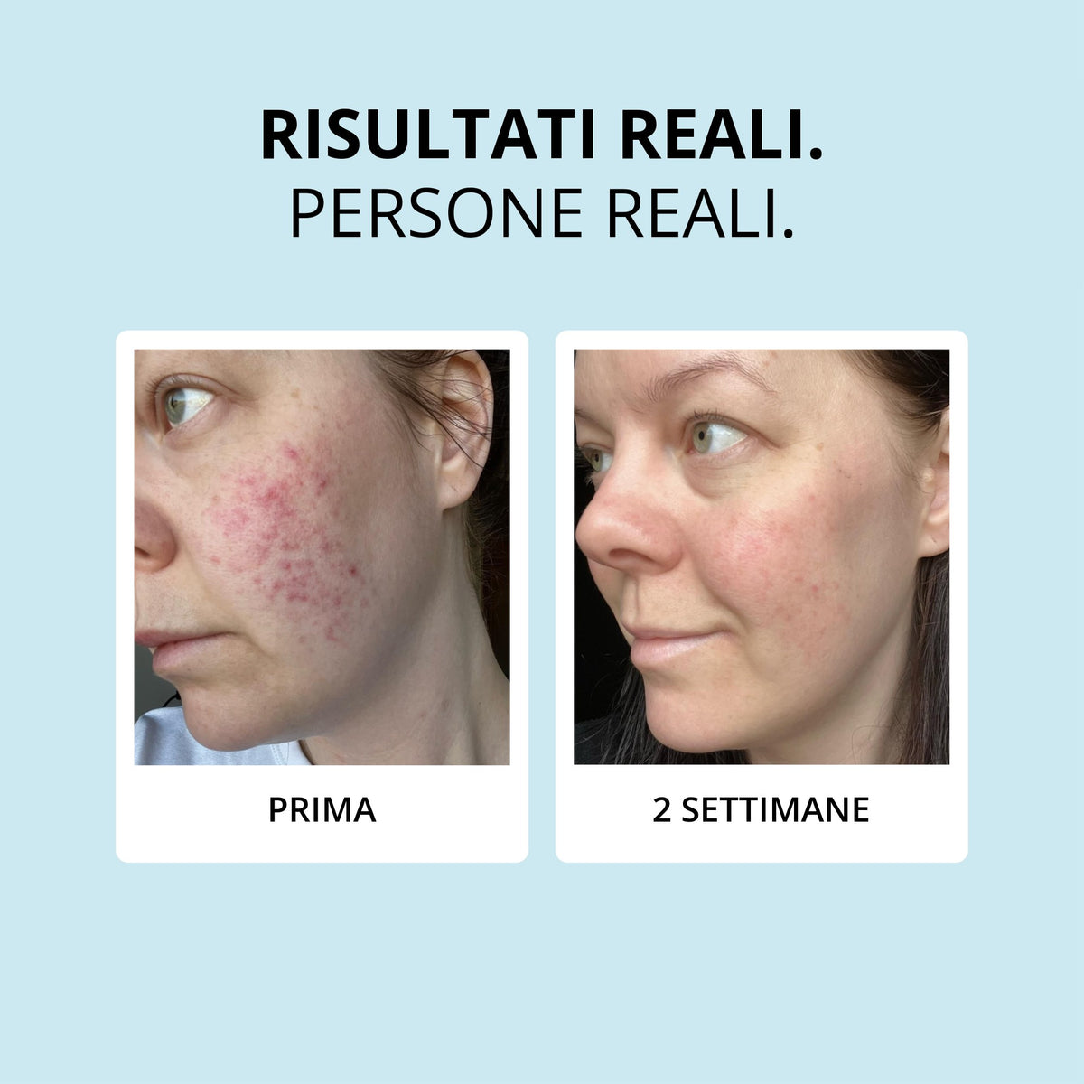 Glowwa Collagen Creamer: risultati reali, prima e dopo 2 settimane