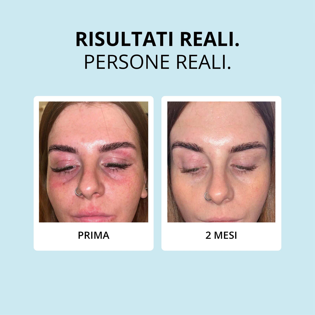 Glowwa Collagen Creamer: risultati reali, prima e dopo 2 mesi