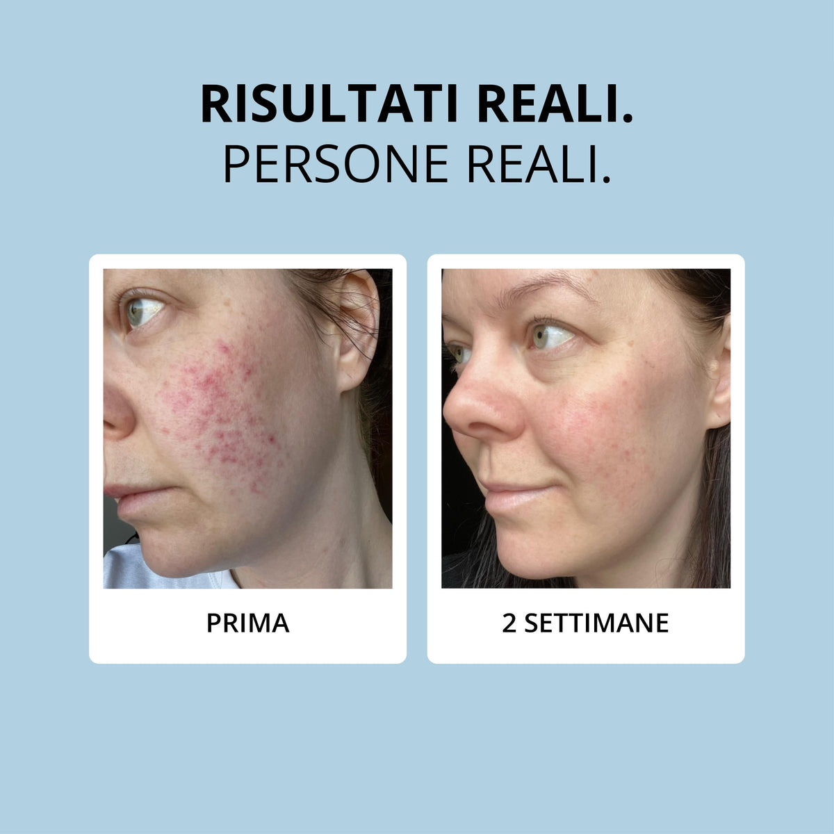 Glowwa Collagen: risultati reali, prima e dopo 2 settimane