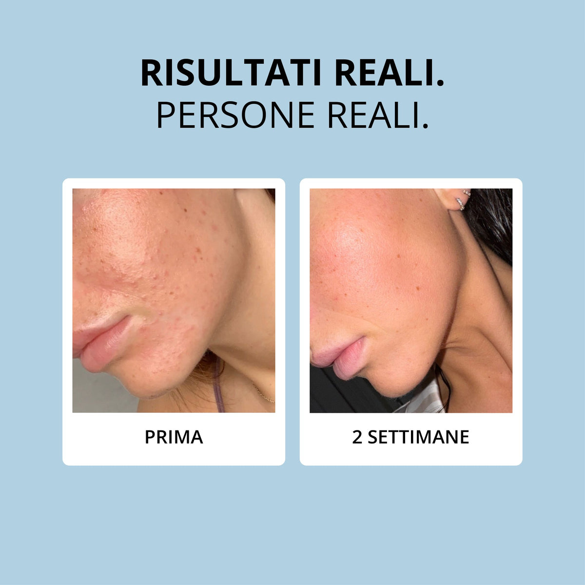 Glowwa Collagen: risultati reali, prima e dopo 2 settimane