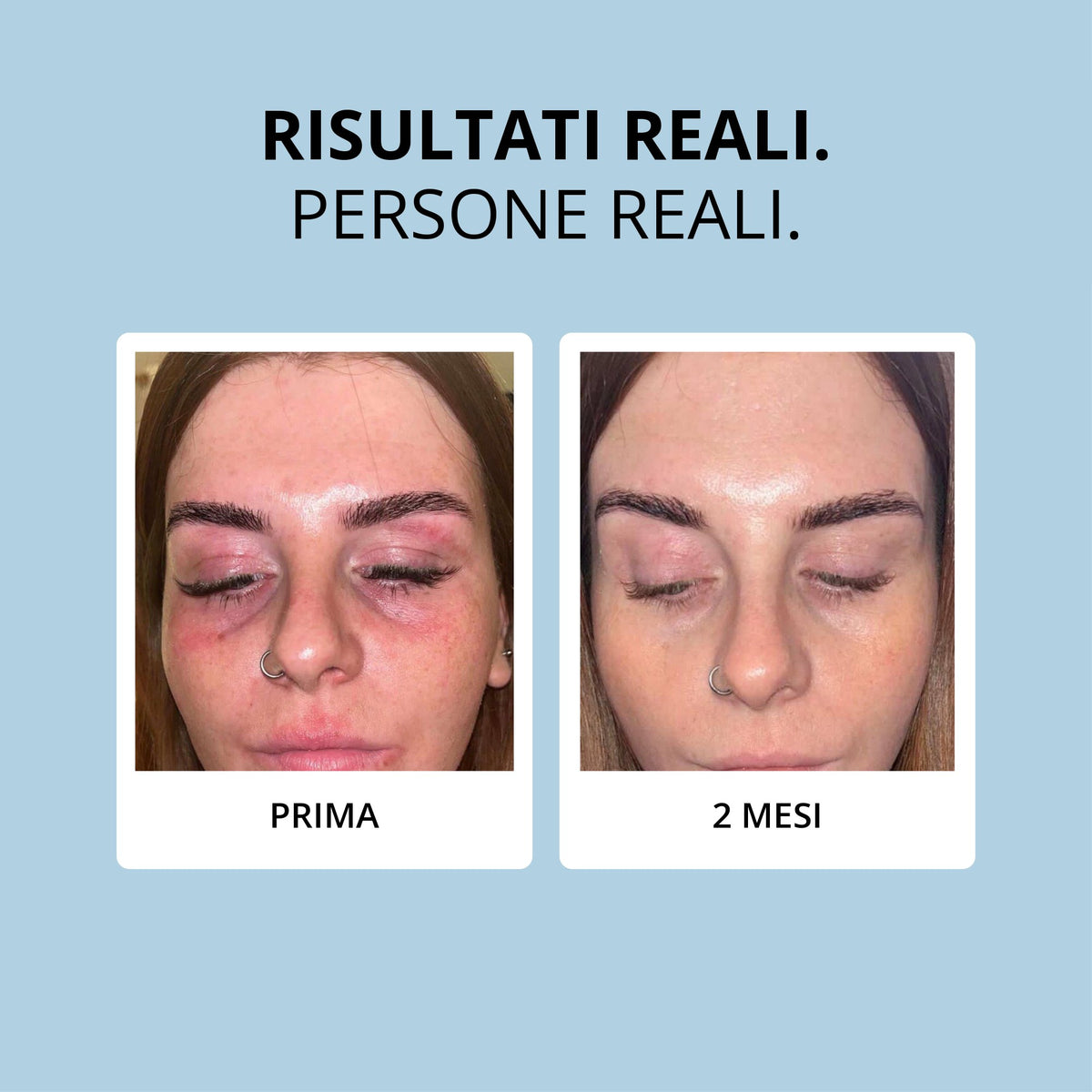Glowwa Collagen: risultati reali, prima e dopo 2 mesi