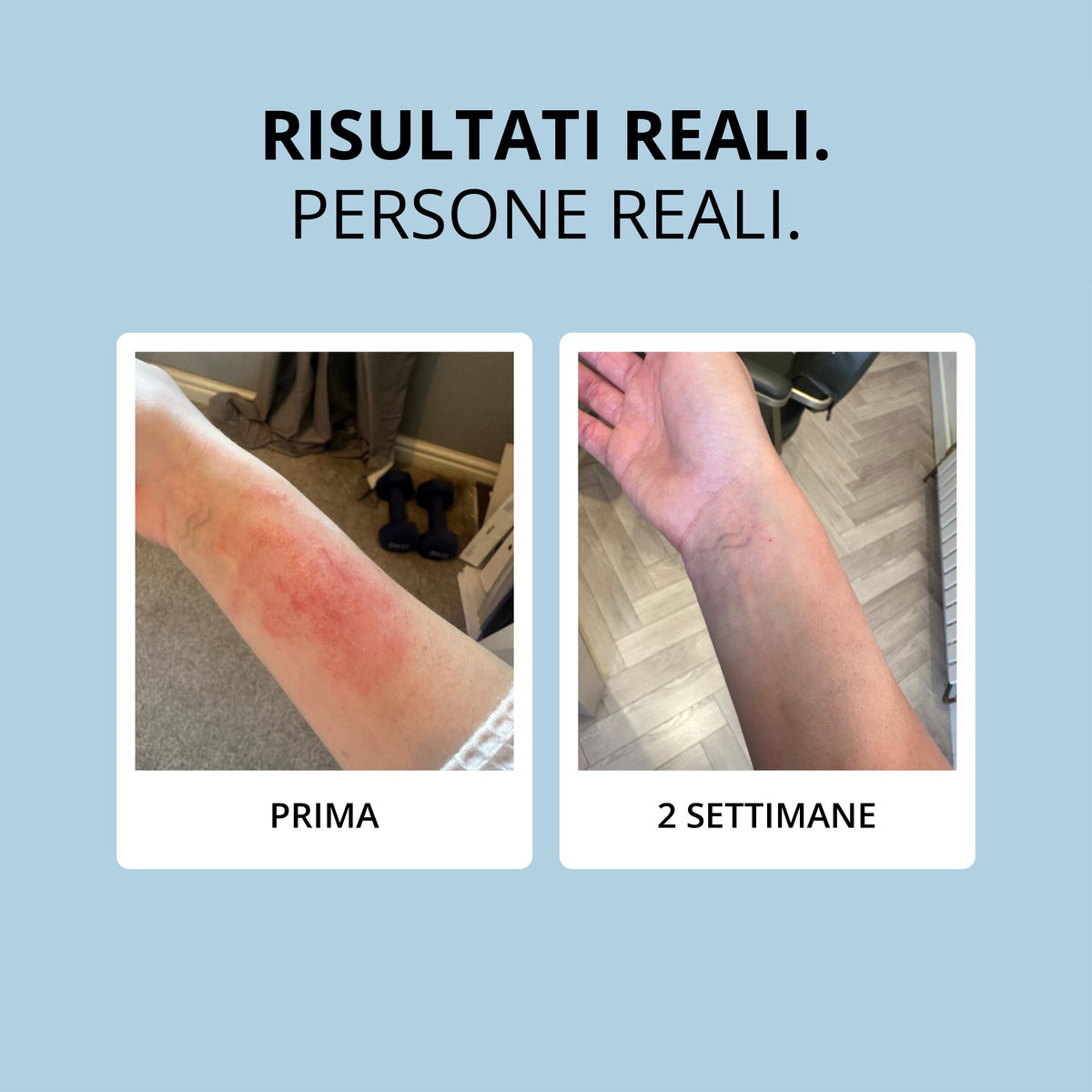 Glowwa Collagen: risultati reali, prima e dopo 2 settimane