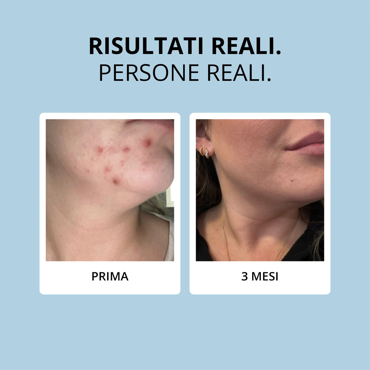 Glowwa Collagen: risultati reali, prima e dopo 3 mesi
