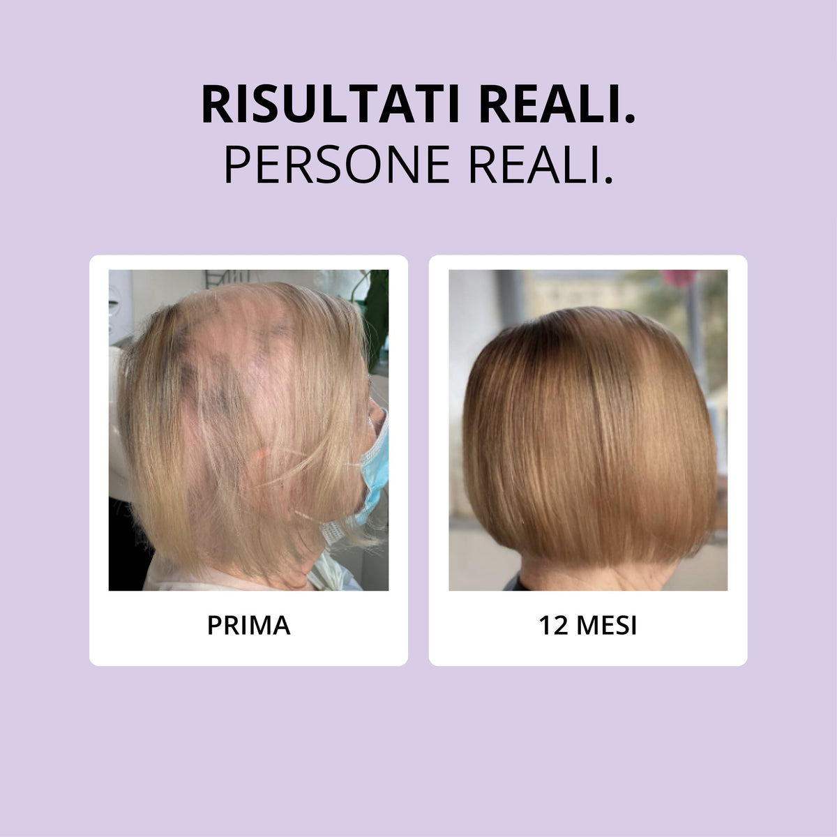 Glowwa Hair Food Meno: risultati reali, prima e dopo 12 mesi