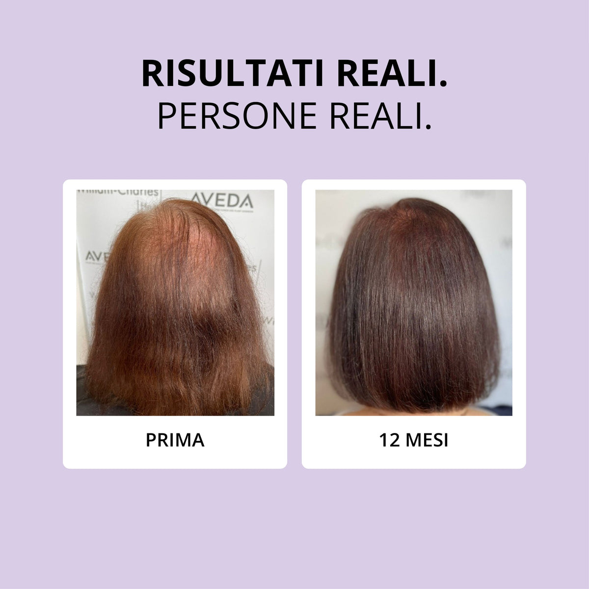 Glowwa Hair Food Meno: risultati reali, prima e dopo 12 mesi
