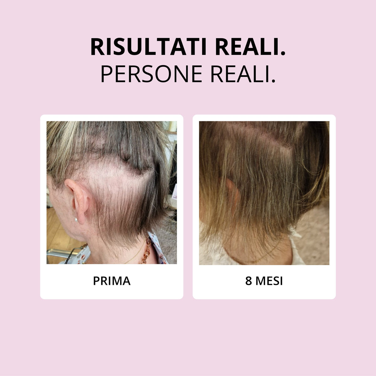 Glowwa Hair Food: risultati reali, prima e dopo 8 mesi