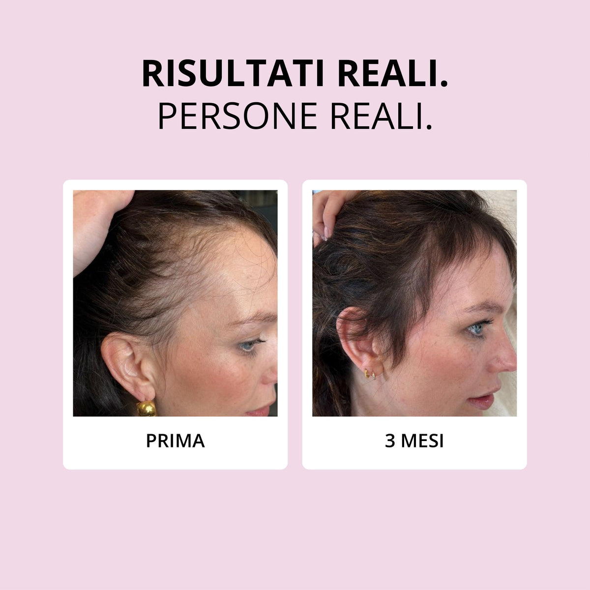 Glowwa Hair Food: risultati reali, prima e dopo 3 mesi